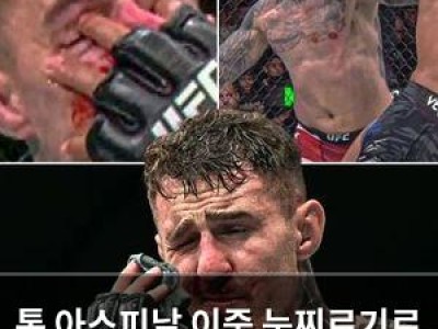 톰 아스피날 이중 눈찌르기로 경기 중단 유명세