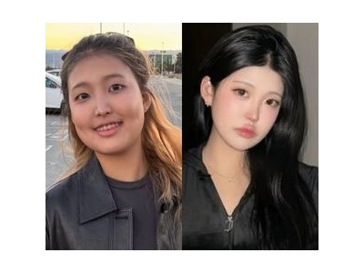 홍진경 딸 성형 의혹 직접 해명 수술이 아니라 보정