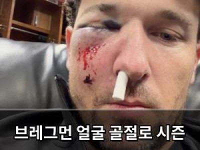 브레그먼 얼굴 골절로 시즌 끝났다며 걱정했지만 복귀 노리는 듯